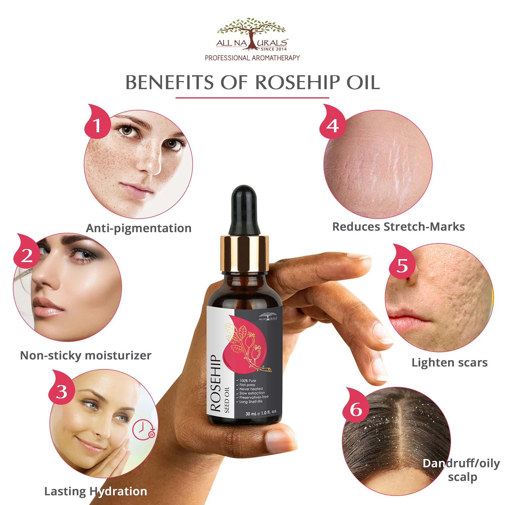 Pure Cold-Pressed Rosehip Seed Oil 30ml - Undiluted & Natural Carrier Oil for Skin Lightening, Pigmentation, Stretch Marks, Acne Scars & Anti-Aging | Hydrates & Rejuvenates Face, Body & Hair | Perfect for DIY Skincare, Massage & Aromatherapy