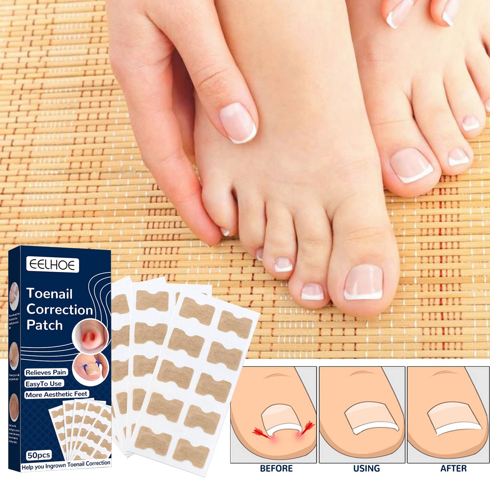 50 PCS Curved Toenail Support Stickers - Nail Correction & Repair Patches for Thick Toenails - Electric Nail File Accessories - Perfect for Pedicures, Manicures & Ingrown Toenail Relief