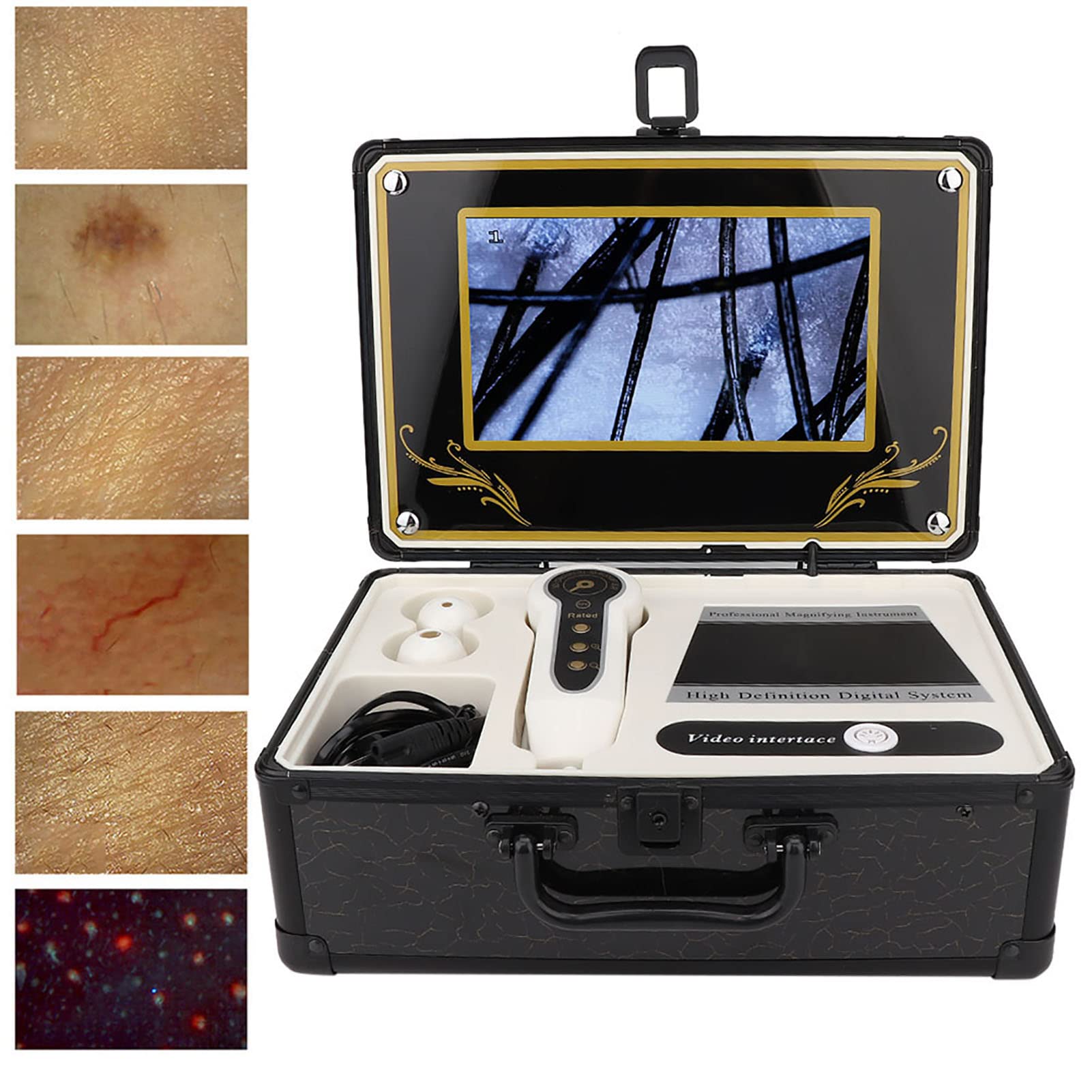 50X-200X Skin & Hair Analyzer Microscope - Professional Scalp Detector for Hair Follicle & Oil Analysis | Skin Care Diagnostic Tool with Magnifying Lens (US Plug) | Perfect for Home Hair Care & Dermatology Checkups
