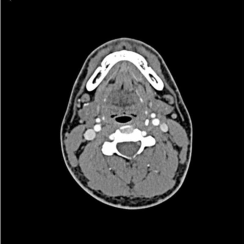 CTA AVM / Lesion Head and Neck Phantom for CT Scan & X-Ray Training - Medical Imaging Practice, Radiology Education, and Diagnostic Procedure Simulation