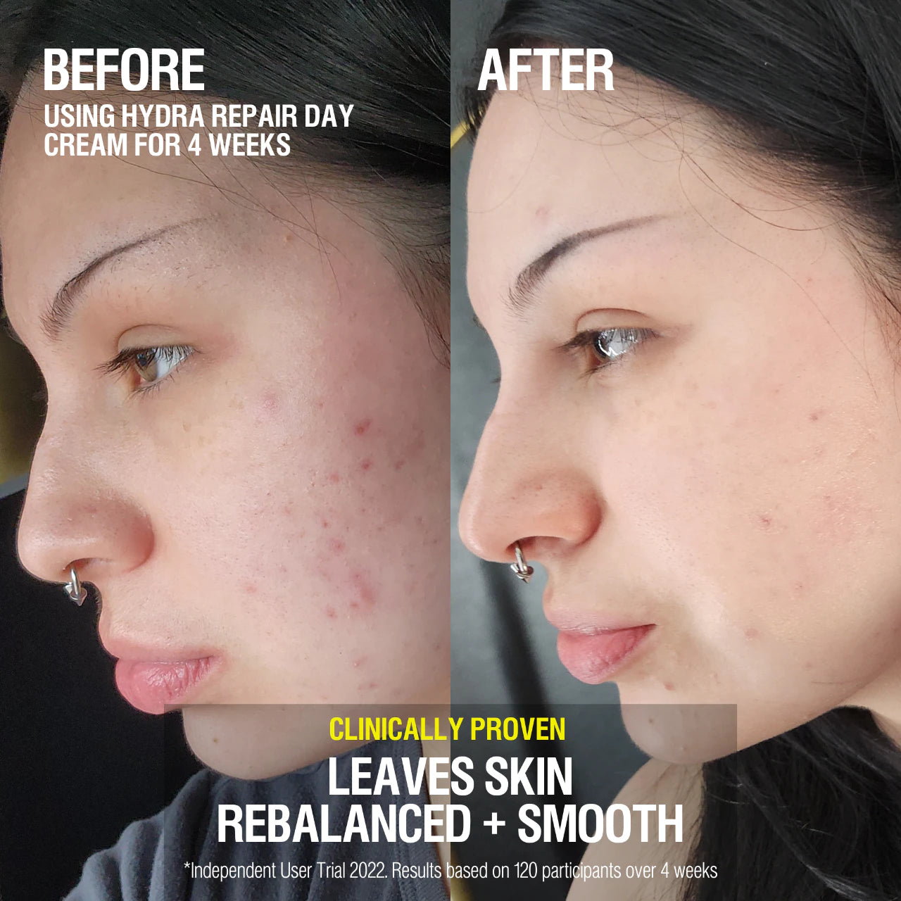 Grown Alchemist Skin Barrier Essentials Kit - Hydrating & Repairing Skincare Set for Dry & Sensitive Skin - Perfect for Night Routine & Travel Skincare