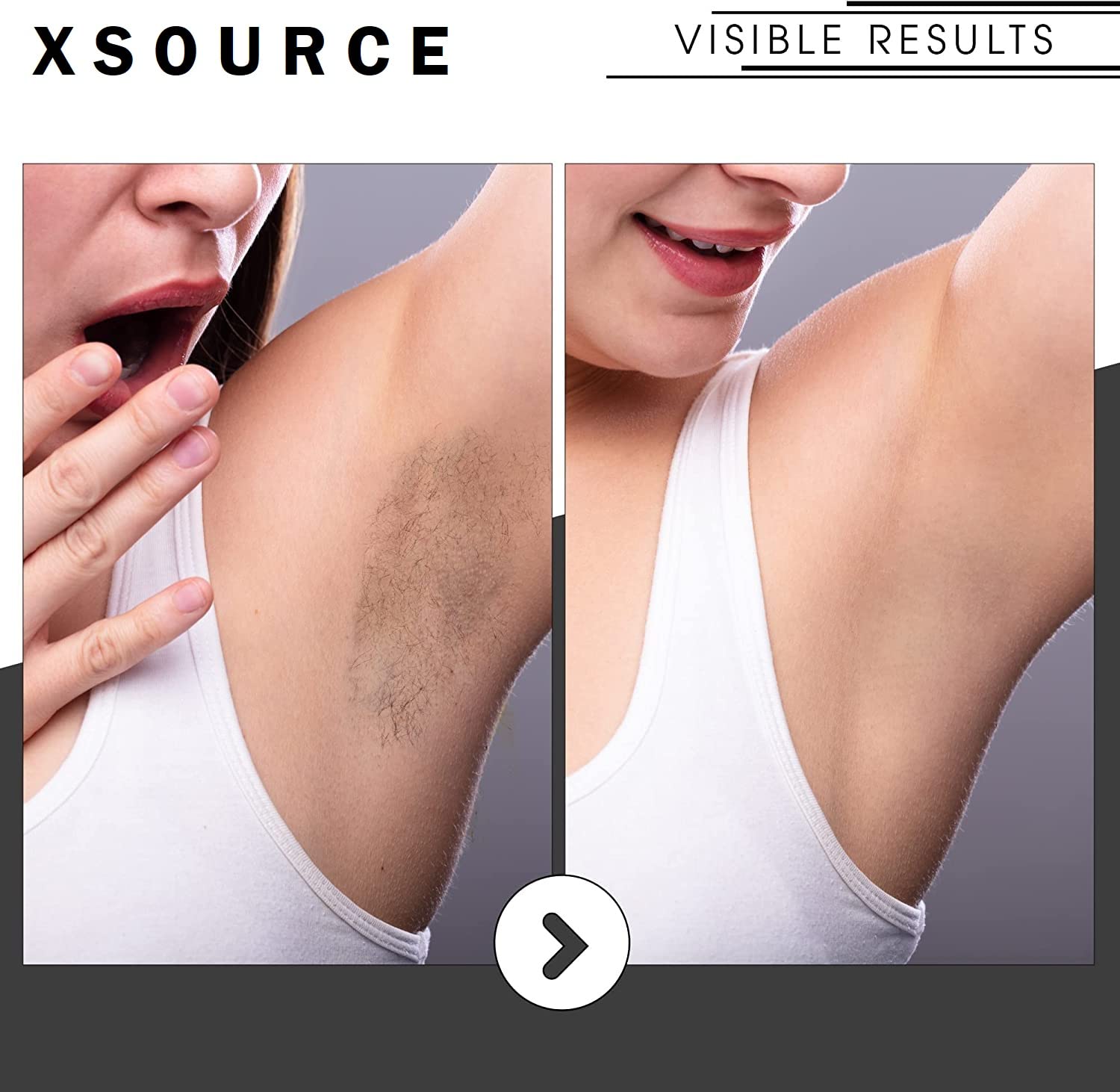 XSOURCE Crystal Hair Remover for Women & Men - Upgraded Nano-Crystalline Dots Technology, Painless & Reusable Hair Removal Stone - Perfect for Facial, Legs, Arms & Bikini Line Hair Removal at Home (Multicolor)
