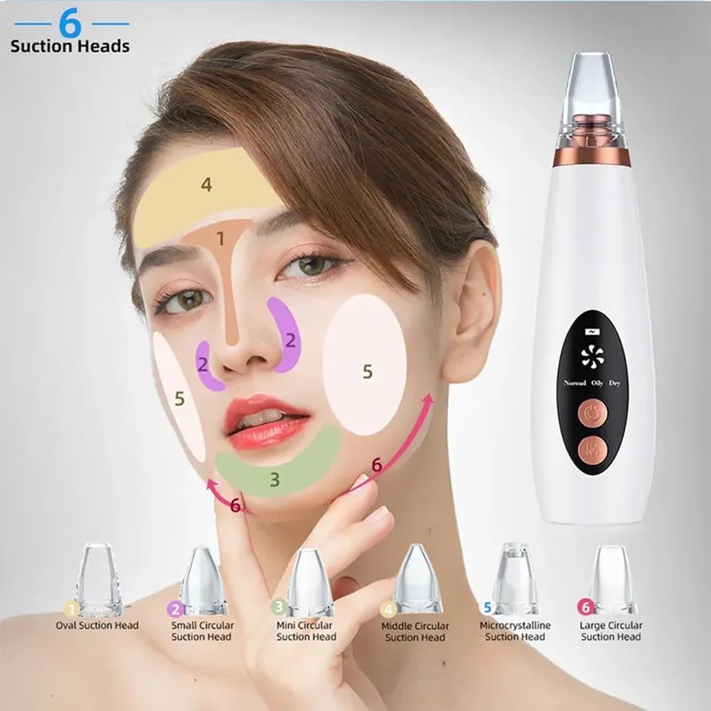 Lukzer Expert Electric Blackhead Remover Vacuum - Professional Derma Suction Tool for Face Cleansing | Men & Women Skincare Device (White) | Perfect for Acne Treatment & Deep Pore Cleaning at Home
