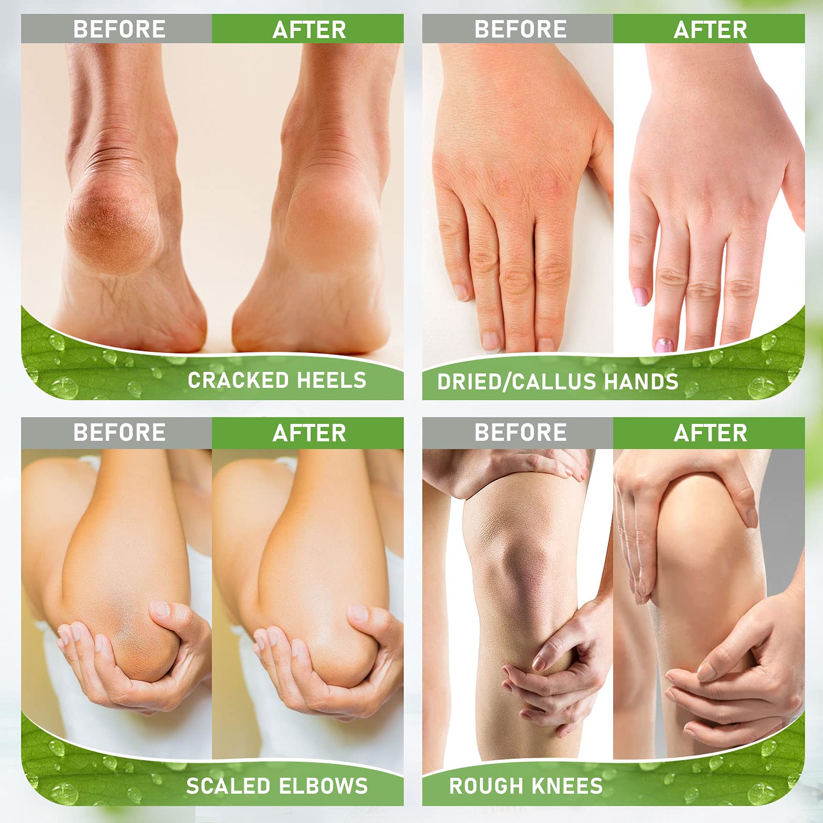 42% Urea Cream with 2% Salicylic Acid - Professional Foot Moisturizer & Callus Remover - Dead Skin Exfoliator & Cracked Heel Repair - 3.5 oz for Dry, Rough Feet - Perfect for Pedicures & At-Home Foot Care