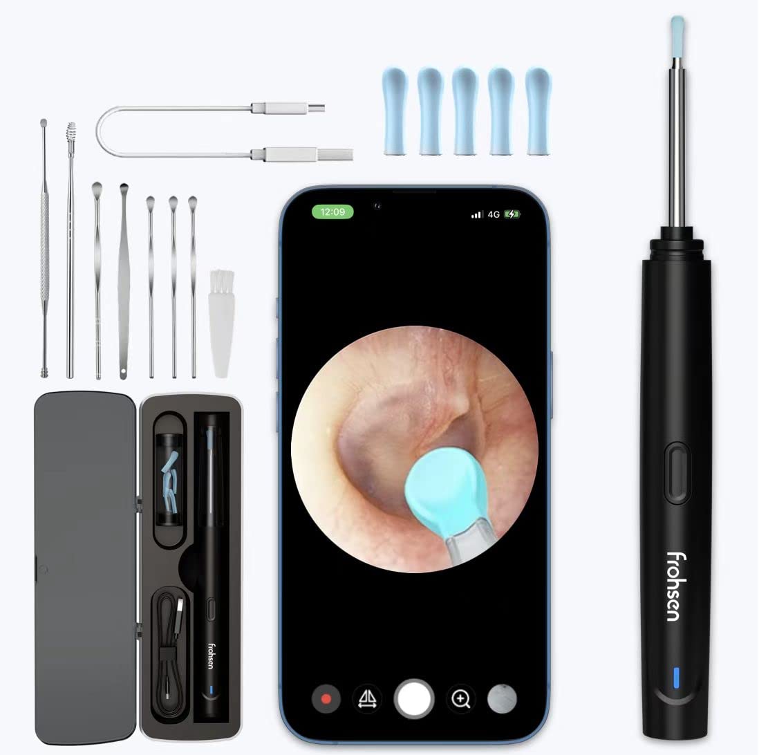 2023 New Edition Frohsen Ear Wax Removal Kit with WiFi HD Camera - Smart Otoscope for Real-Time Ear Cleaning, Compatible with iOS & Android - Perfect for Home Use, Travel, and Kids' Ear Care