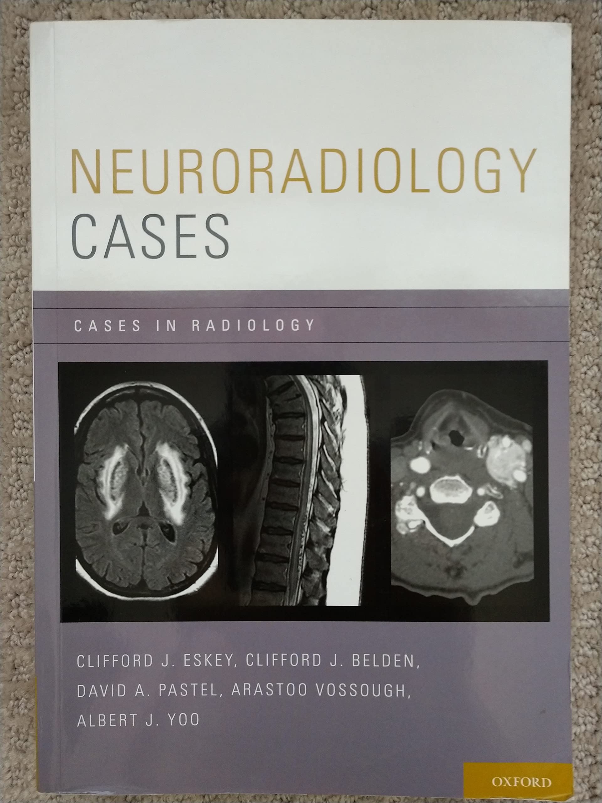 Neuroradiology Cases: Diagnostic Imaging Studies for Brain & Spine Disorders | Radiology Casebook for Medical Students & Residents | Perfect for Clinical Practice & Board Exam Prep
