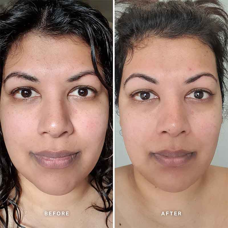 Alpha H Vitamin C Serum with 10% Ethyl Ascorbic Acid - Brightening & Anti-Aging Face Serum for Dark Spots & Wrinkles - Perfect for Daily Skincare Routine & Nighttime Use