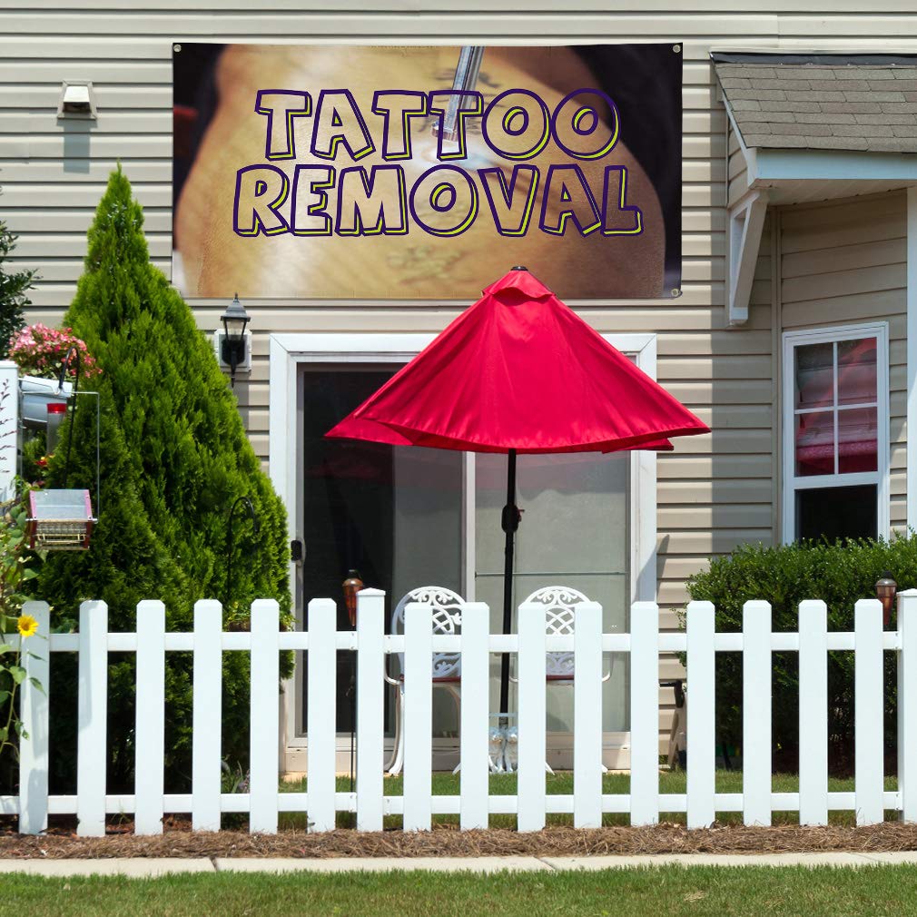 Custom Vinyl Banners 48x96 Inches - Heavy Duty Weatherproof Outdoor Sign with 8 Grommets for Tattoo Removal Advertising, Business Promotion & Yard Signs (Multiple Sizes Available) - Perfect for Trade Shows, Storefronts & Event Marketing