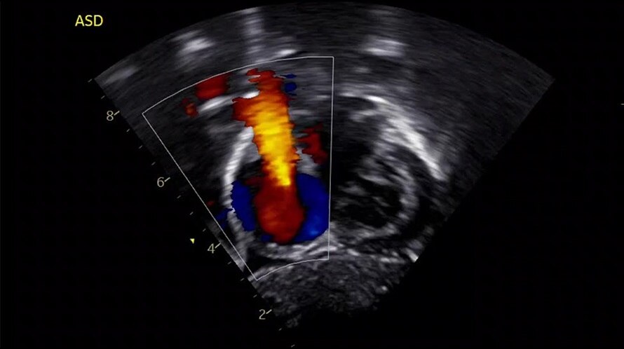 GE Vivid IQ Ultra Edition Portable Ultrasound System - High-Resolution Imaging for Cardiac & OB/GYN Exams | Perfect for Point-of-Care Diagnostics, Emergency Medicine & Mobile Clinics