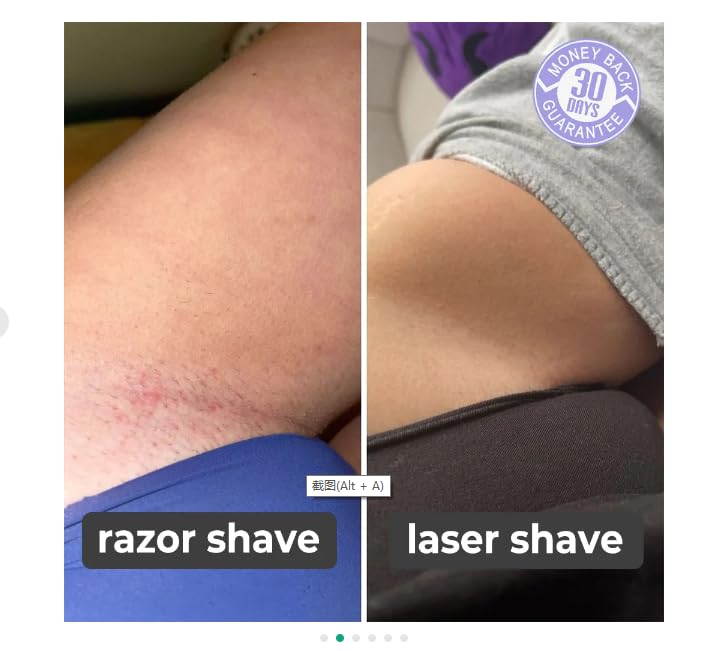 Palanyx Painless Hair Remover for Women - IPL Laser Hair Removal Device with Blue Light Technology for Body & Bikini Area (2 Pack) | At-Home Hair Removal Solution for Smooth Skin
