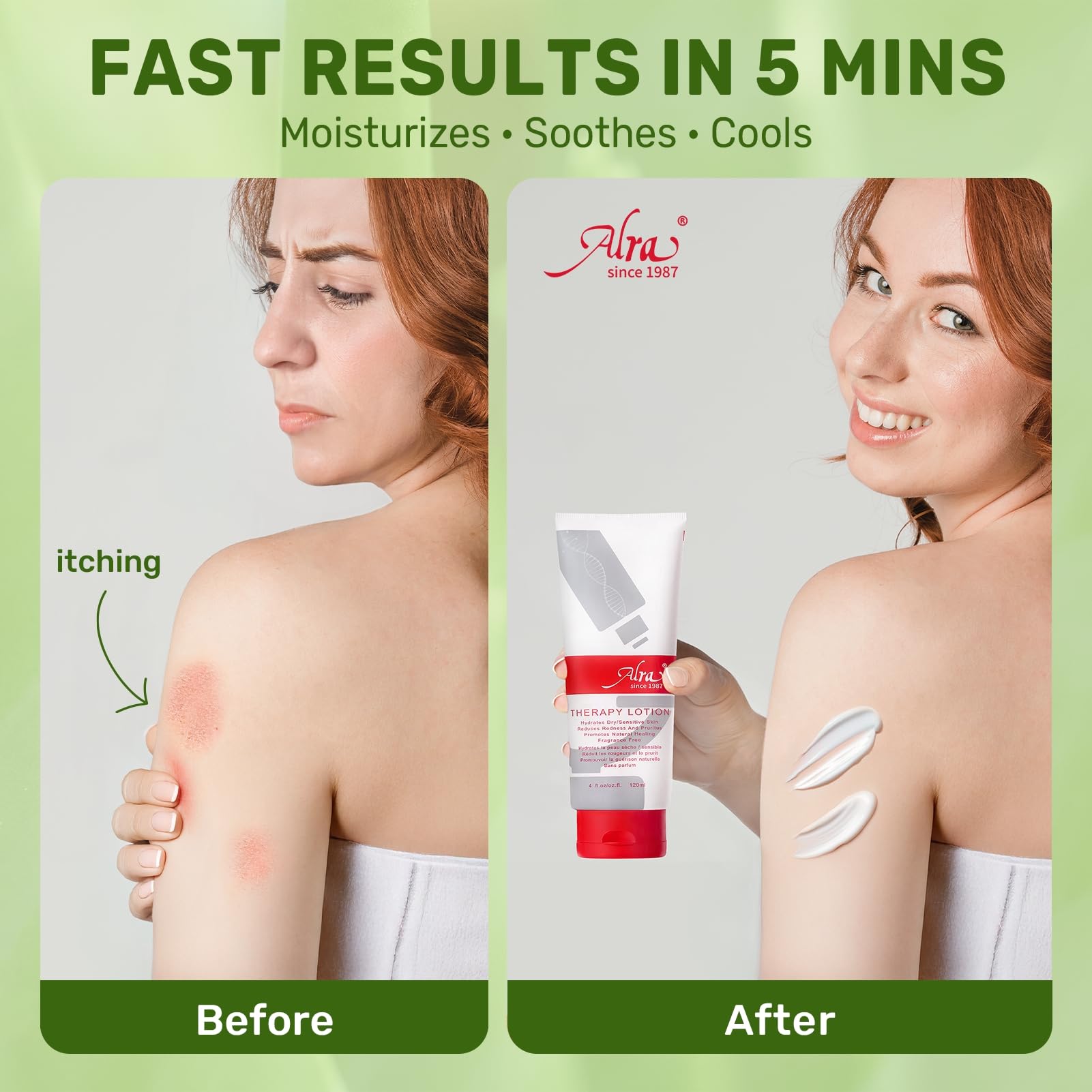 Alra Moisturizing Lotion for Extremely Dry Skin - Aloe Vera, Lanolin & Vitamin E Enriched Face, Hand & Body Cream - Soothes Itch & Sunburn - Fragrance-Free Hydration (4 oz) - Perfect for Post-Sun Care & Winter Skin Relief