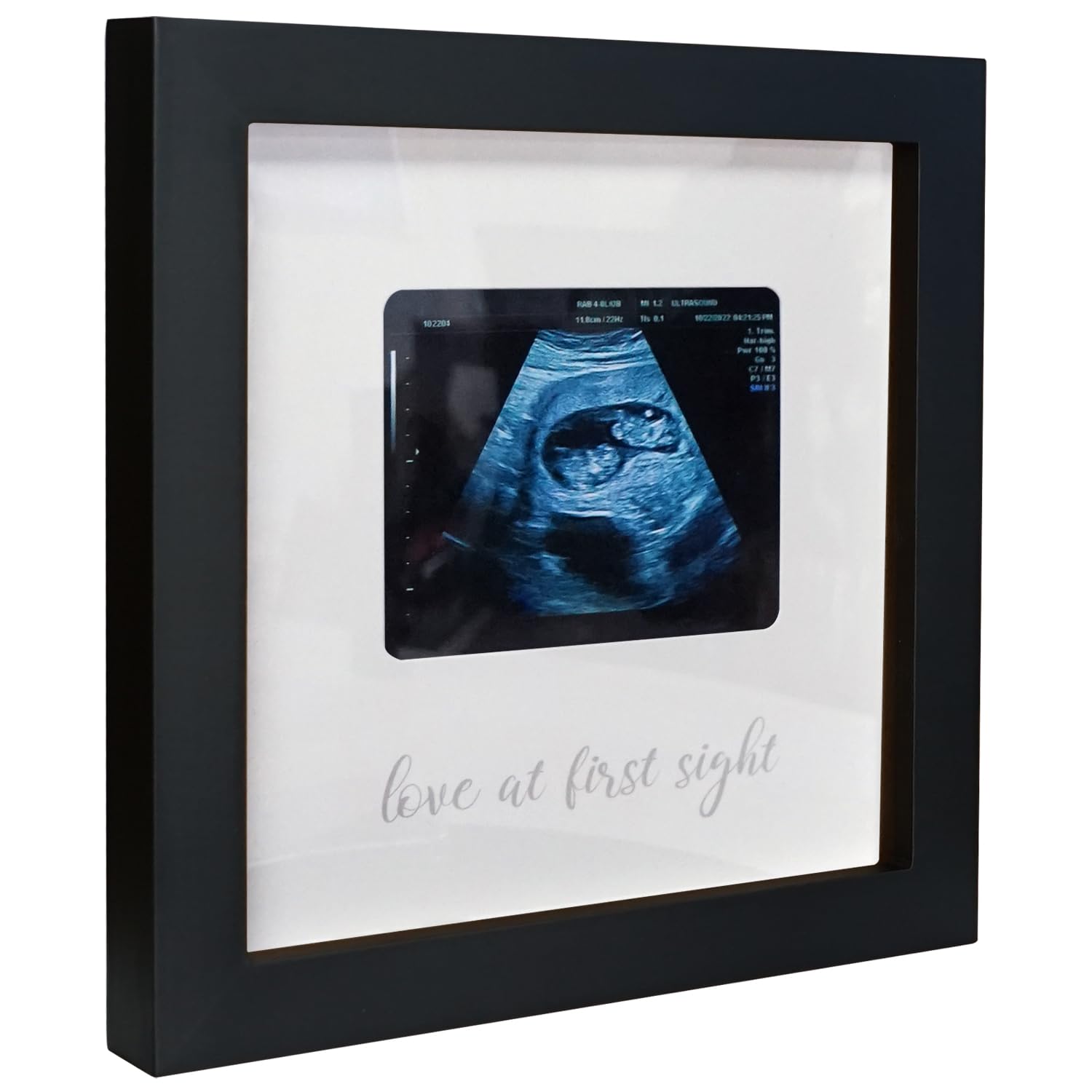 Ultrasound Photo Frame - Pregnancy Announcement Gift for Grandparents - Nursery Decor