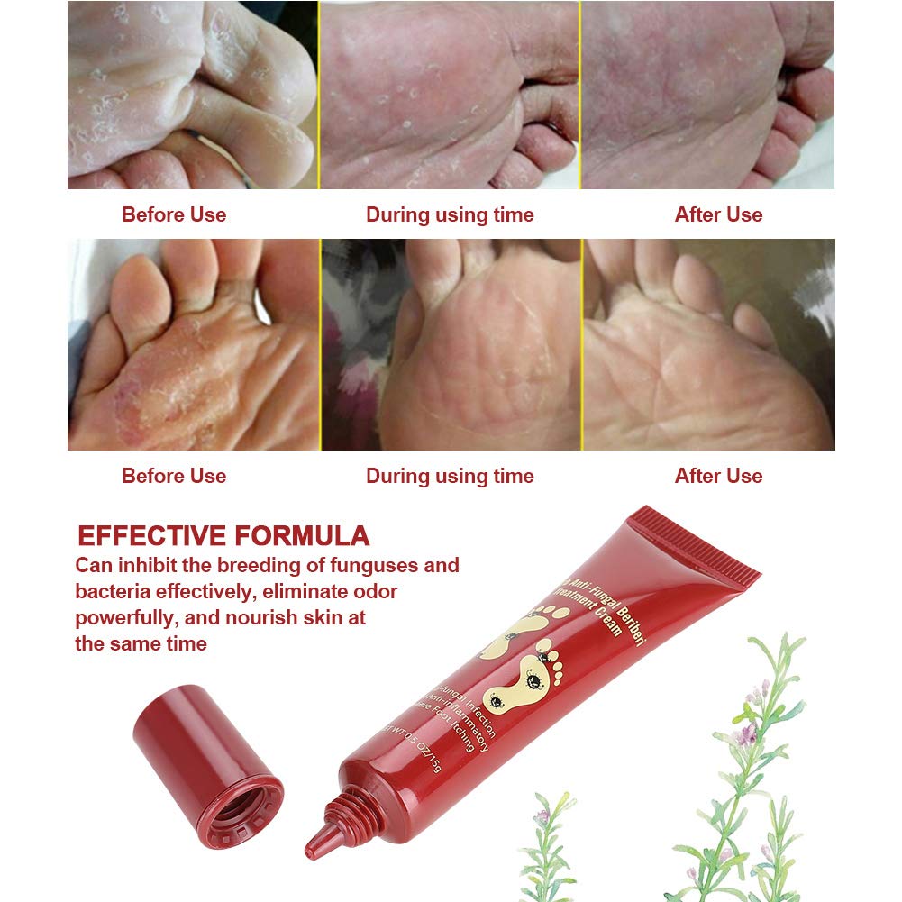 15g Natural Plant Foot Care Cream - Moisturizing Ointment for Fungal Relief & Cracked Heels | Ideal for Athletes, Diabetics & Daily Foot Care