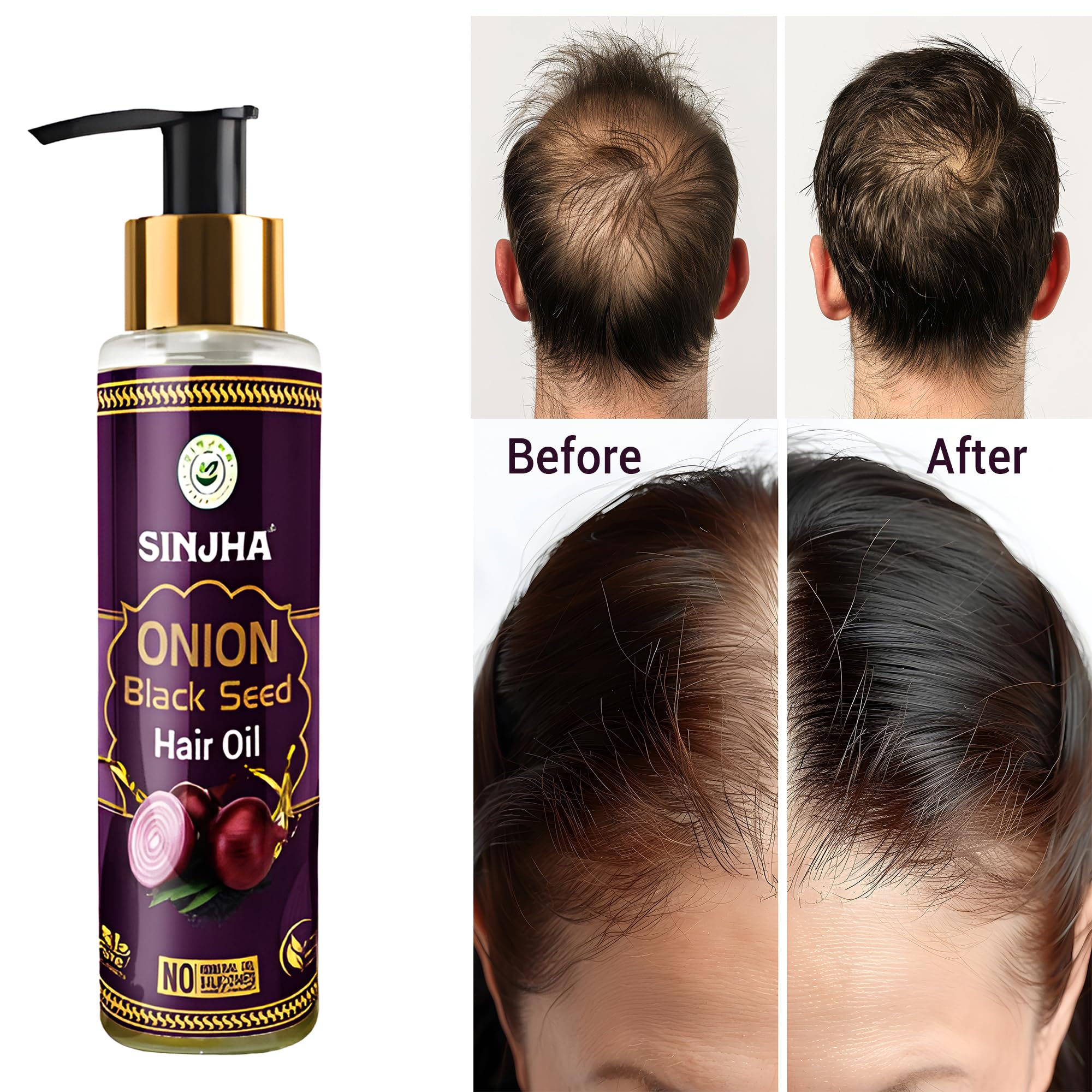 Sinjha Onion Black Seed Hair Oil 100ml - Natural Hair Growth Treatment for Thinning Hair & Hair Loss Control | Perfect for Daily Scalp Massage & Damaged Hair Repair