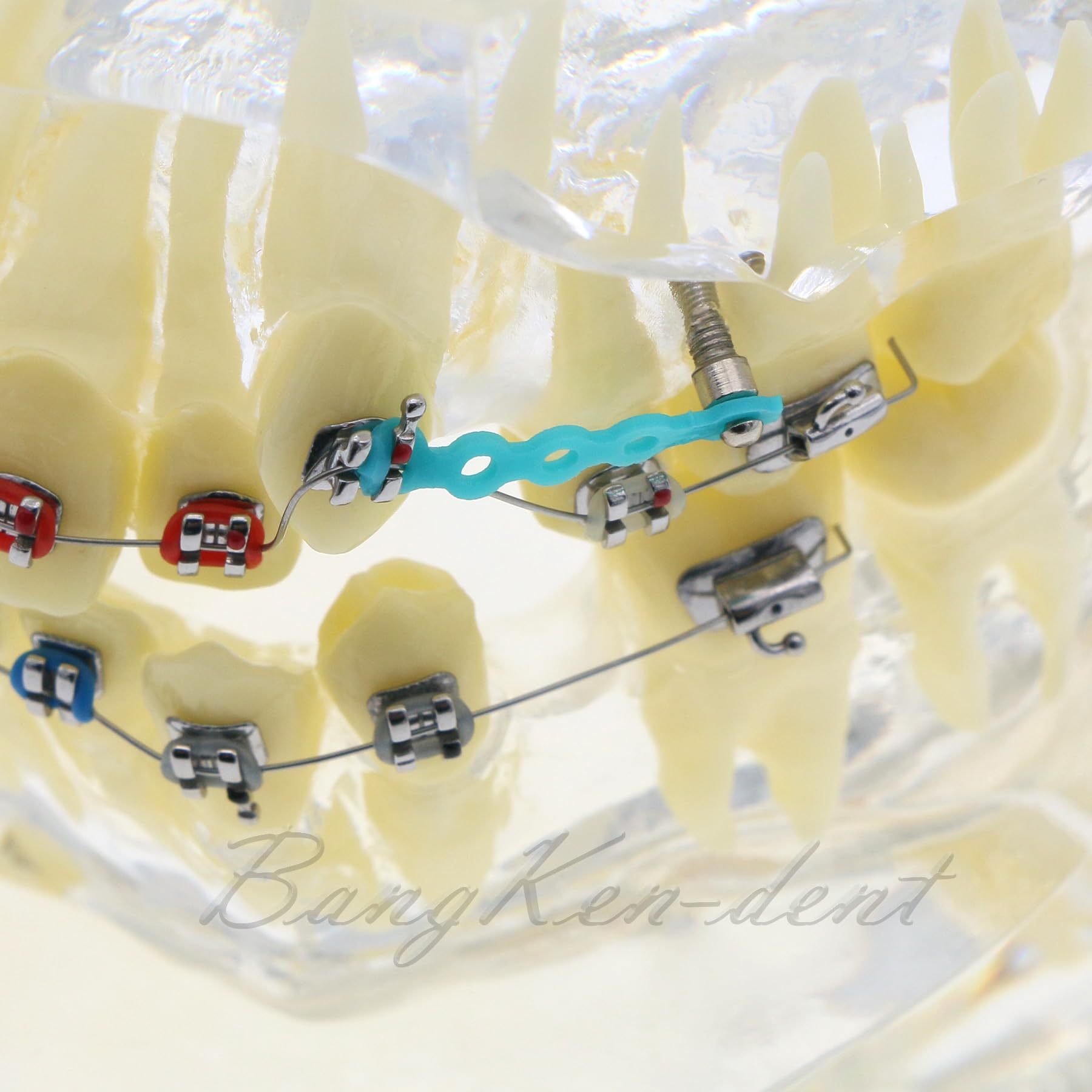 Orthodontic Typodont Dental Model with Braces, Arch Wire, Bracket & Buccal Tube - Premolar Deformity Teaching Demonstration Kit for Dental Students & Professionals (M3005-CLEAR) - Perfect for Dental School Practice, Orthodontic Training & Clinical Demonstrations