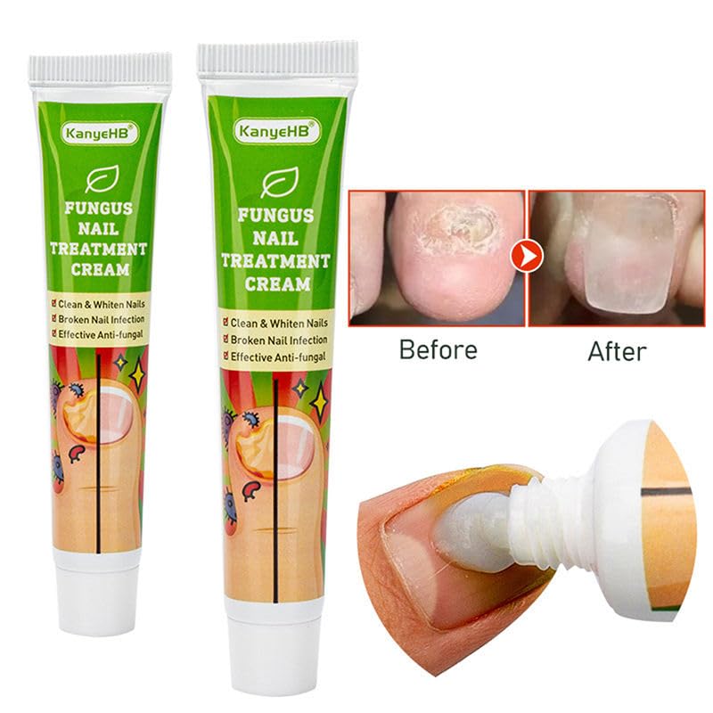 Boxania® KanyeHB Nail Repair Treatment Cream - Promotes Nail Growth, Strengthens & Nourishes Brittle Nails, Improves Aging Nail Appearance - 20g Nail Care Solution for Healthy, Beautiful Nails at Home & Salon