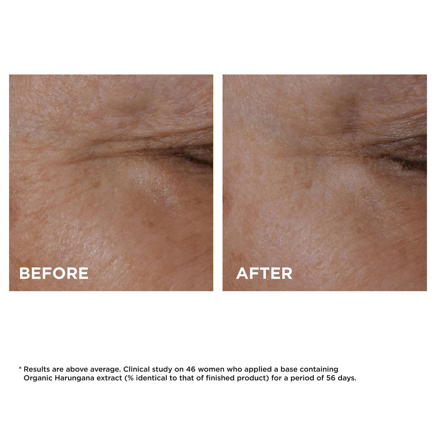 Clarins Total Eye Lift Firming & Smoothing Anti-Aging Eye Cream - 15ml | Reduce Dark Circles & Wrinkles | Perfect for Day & Night Skincare Routine