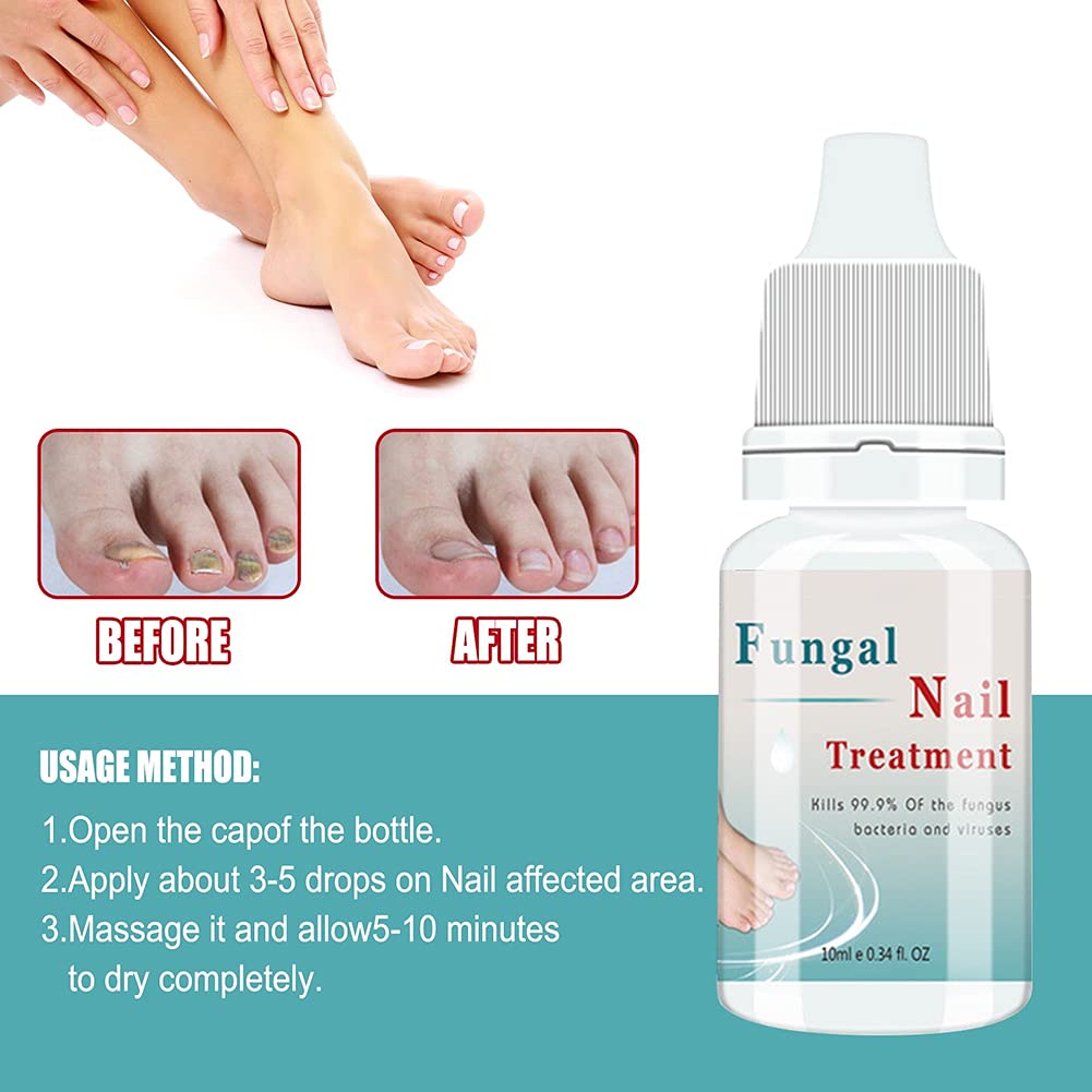 Extra Strong Nail Fungus Treatment - Repair Damaged Toenails for Men & Women - Perfect for Athletes & Daily Use