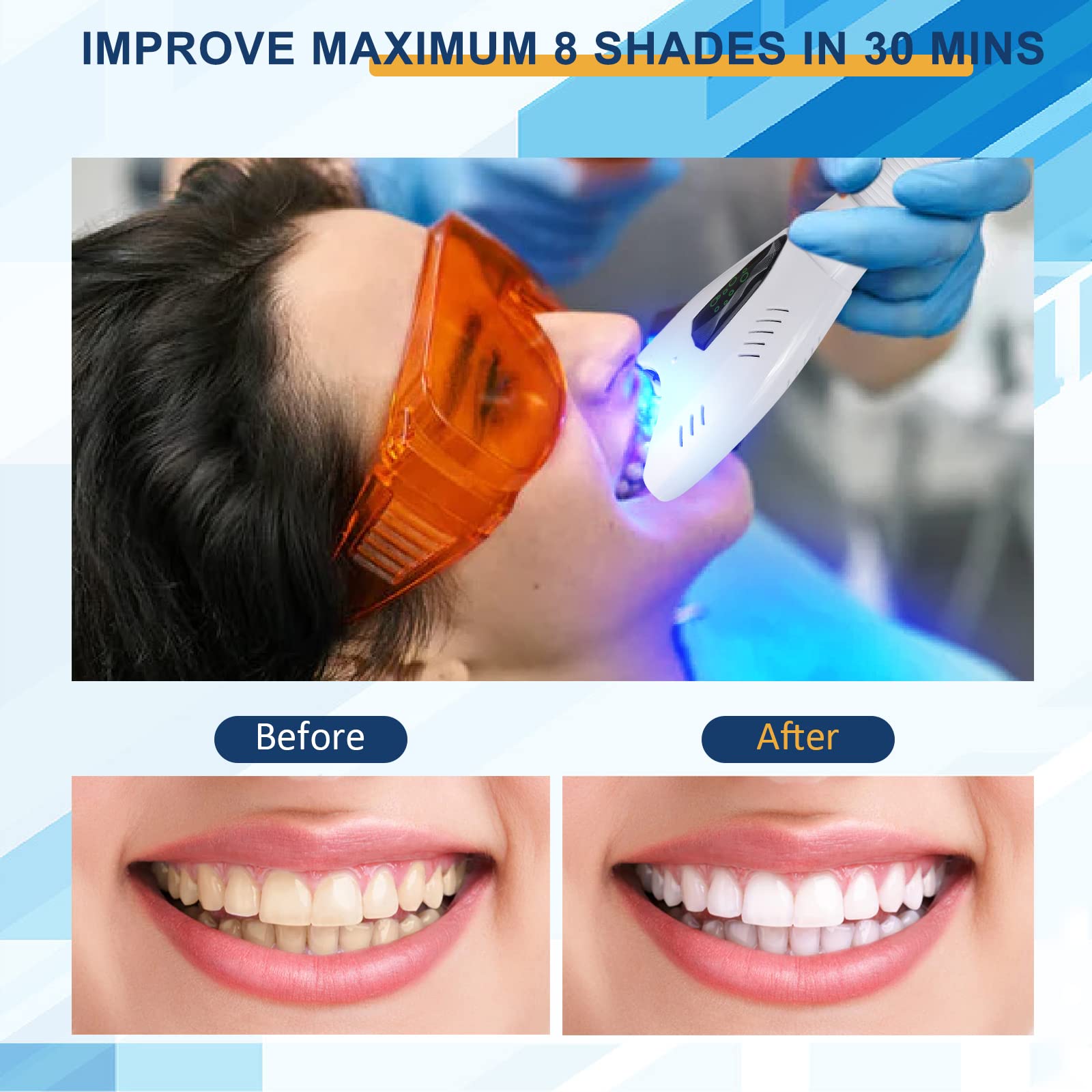 Professional Teeth Whitening Lamp with Adjustable Stand - Cold Blue Light Accelerator for Zoom Whitening Treatments | Perfect for Dental Clinics, Beauty Salons & At-Home Teeth Whitening Care