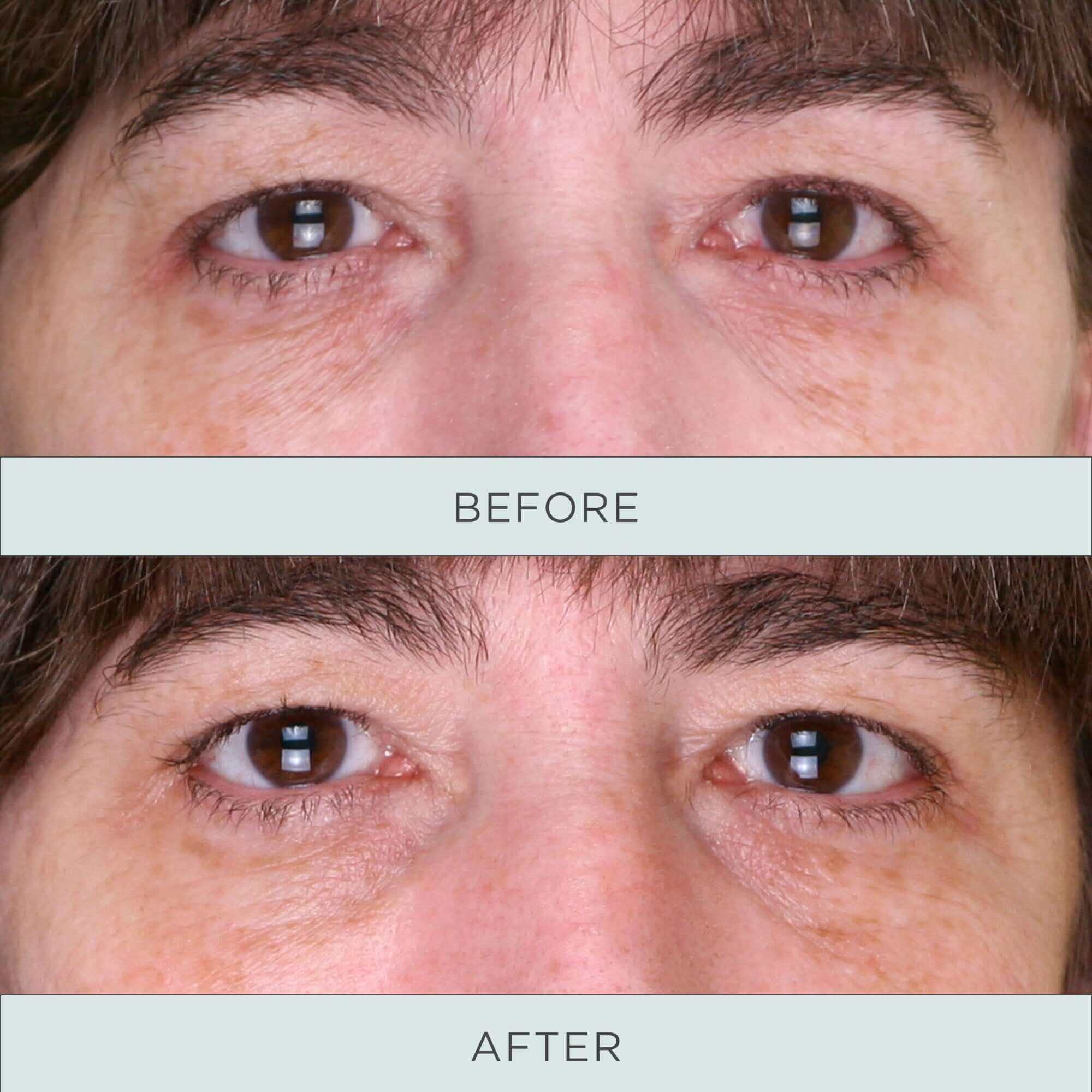 Niacinamide Firming Eye Serum for Dark Circles & Wrinkles - Brightening & Anti-Aging Eye Treatment for Day & Night Use
