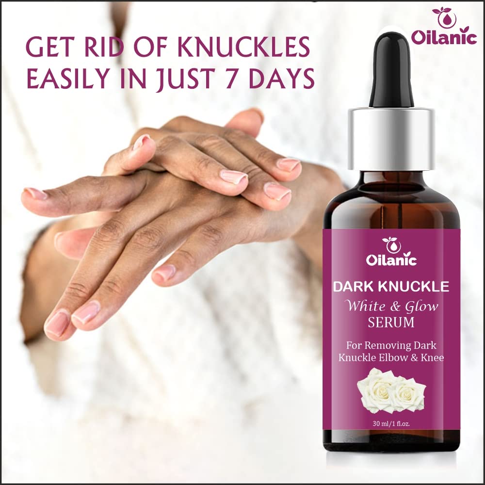 Oilanic Dark Knuckle Serum for Dark Spot Removal & Skin Brightening (30ml) | Hydrating & Nourishing Formula for Smooth Skin | Lightweight Non-Greasy Daily Skincare | Perfect for Dry Elbows, Knees & Knuckles