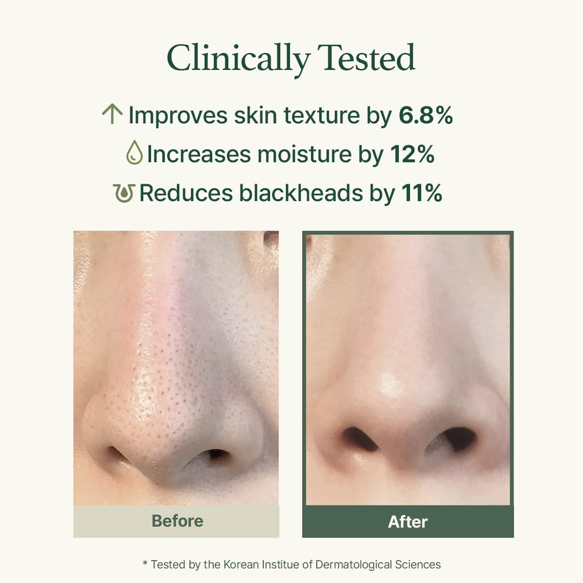 Korean Rice Mochi Face Cleanser Set - Deep Pore Cleansing for Sensitive Skin | Acne & Blackhead Treatment