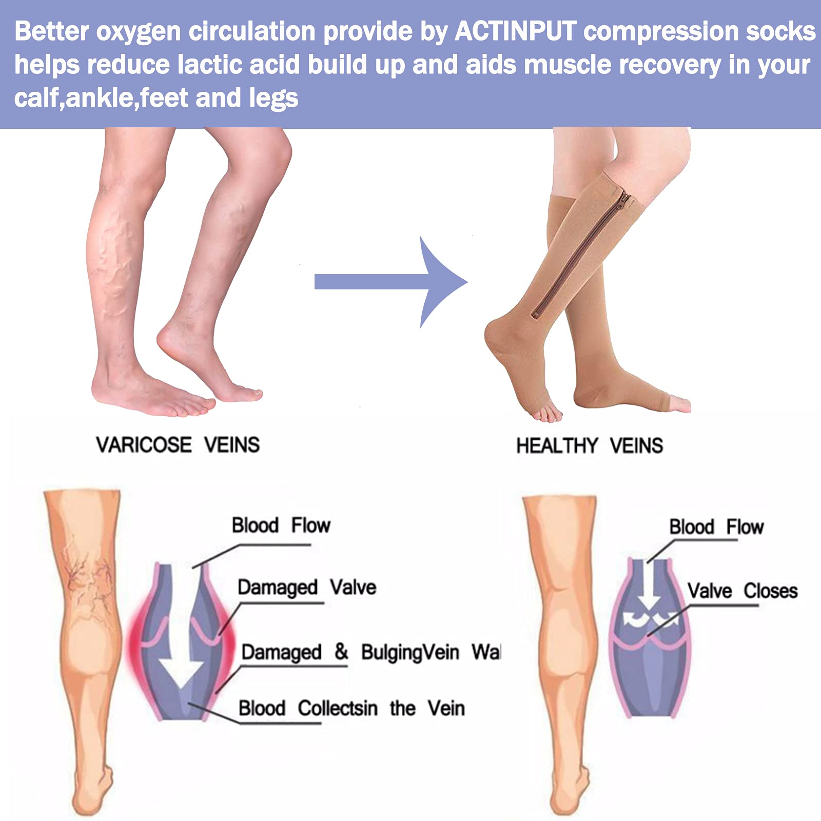 ACTINPUT 2 Pairs Open Toe Compression Socks for Women & Men - Knee High Support Stockings with Zipper for Circulation, Running, Travel & Nursing - Ideal for Varicose Veins Relief & Post-Surgery Recovery