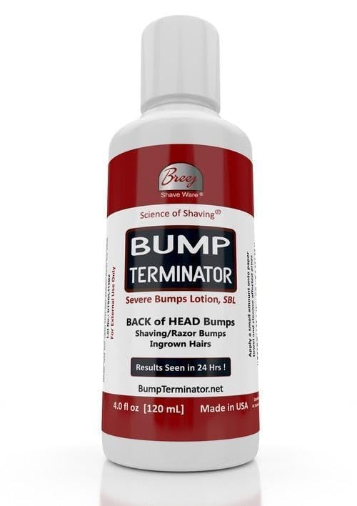 BUMP TERMINATOR - Best Razor Bumps & Ingrown Hair Treatment for Men & Women | Prevents & Soothes Bikini Bumps, Back of Head Bumps | 4 oz | Perfect for Post-Shave Care & Sensitive Skin Relief