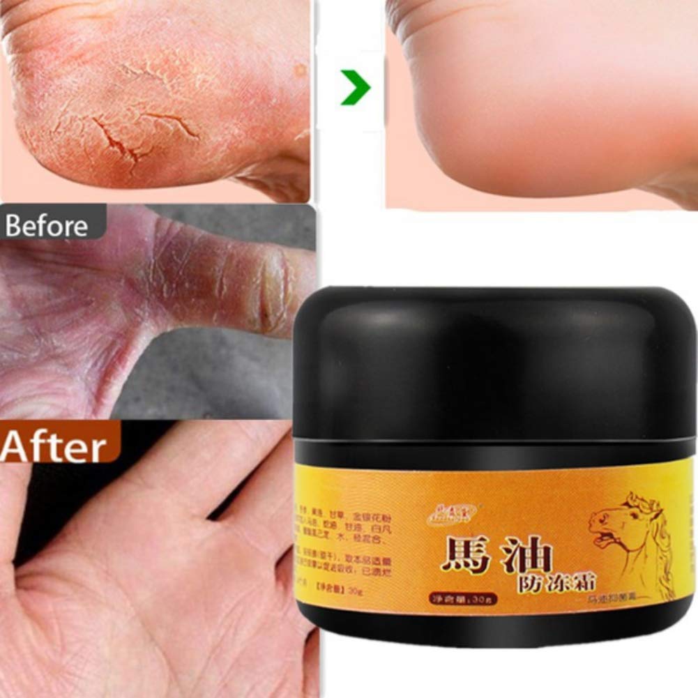 Allbestaye Horse Oil Foot Cream for Dry Cracked Heels - Intensive Repairing Moisturizer for Rough & Chapped Feet - Best for Cracked Heel Treatment & Foot Care at Night
