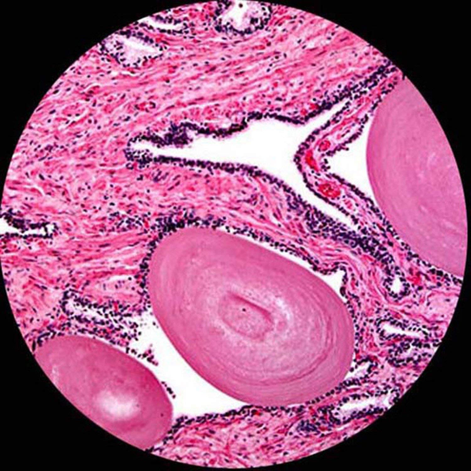 AmScope U230B 3.0MP USB Digital Microscope 40x-2000x for Lab & Education