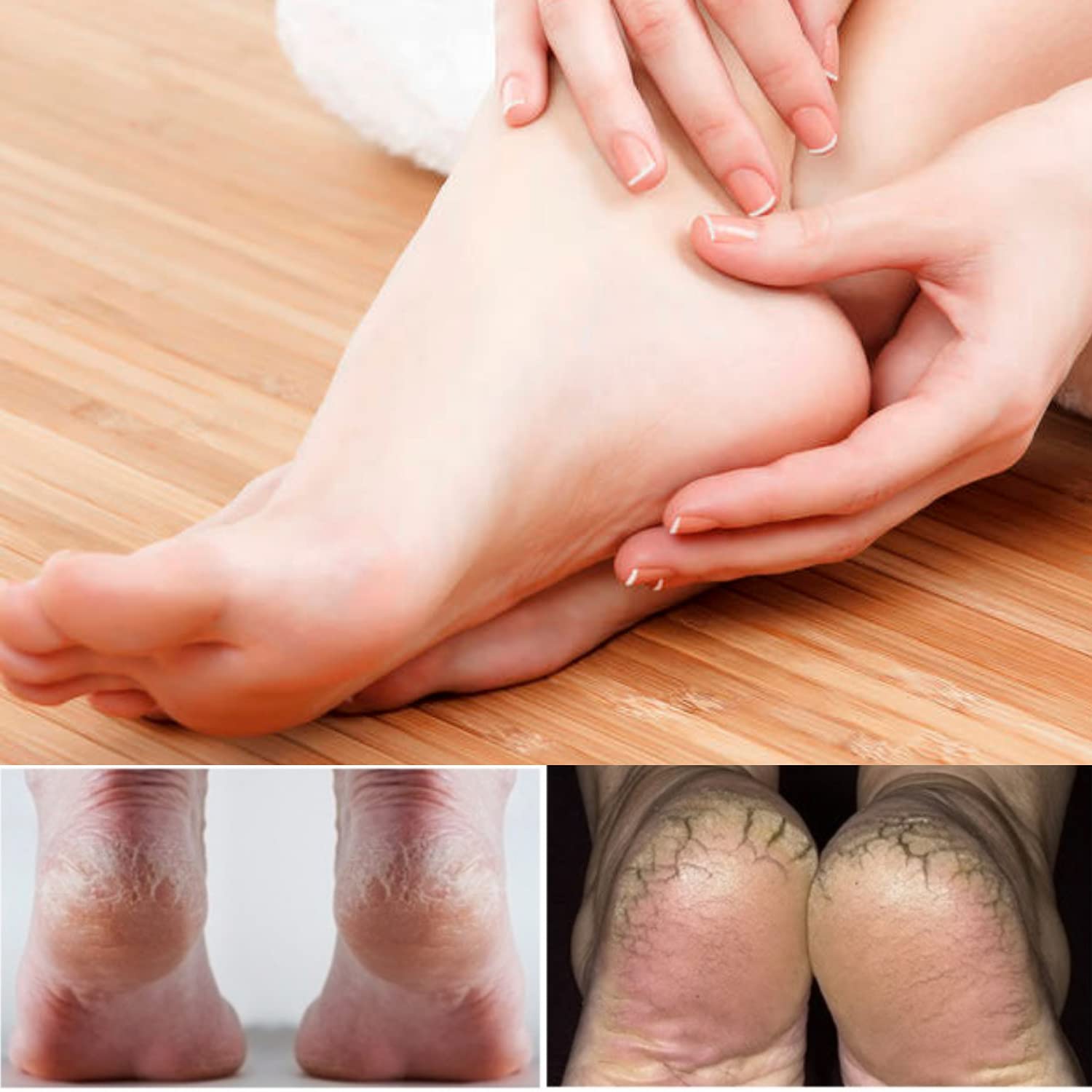 Gel Heel Cups Sleeves for Pain Relief - Silicone Heel Cushion Pads for Dry Cracked Heels, Achilles Tendonitis & Plantar Fasciitis Support - Comfortable Foot Care for Men & Women (1 Pair) - Perfect for Running, Walking & Daily Wear