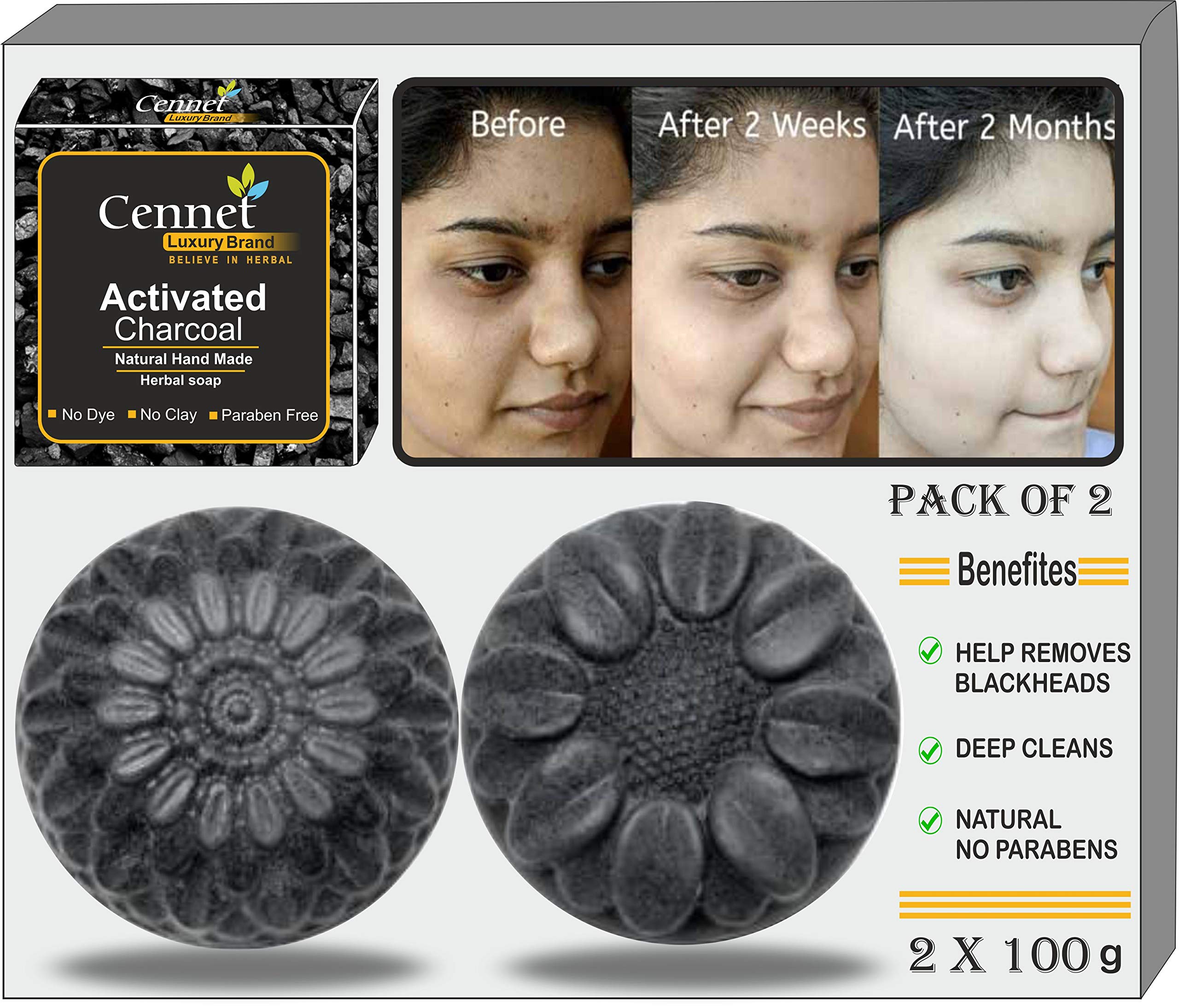Mahalaxmi Creation Women's Cennet Handmade Charcoal Skin Whitening Soap - Natural Detox Face & Body Cleanser for Acne, Blackheads, Anti-Wrinkle & Pimple Care (200g, Pack of 2) | Gentle Daily Cleansing for Glowing Skin, Perfect for Sensitive & Problem Skin Types