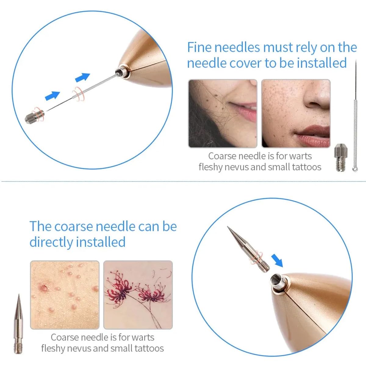 Professional Mole & Spot Remover Pen - Fast & Painless Skin Tag Removal for Face & Body - Perfect for Home Use & Travel Skincare