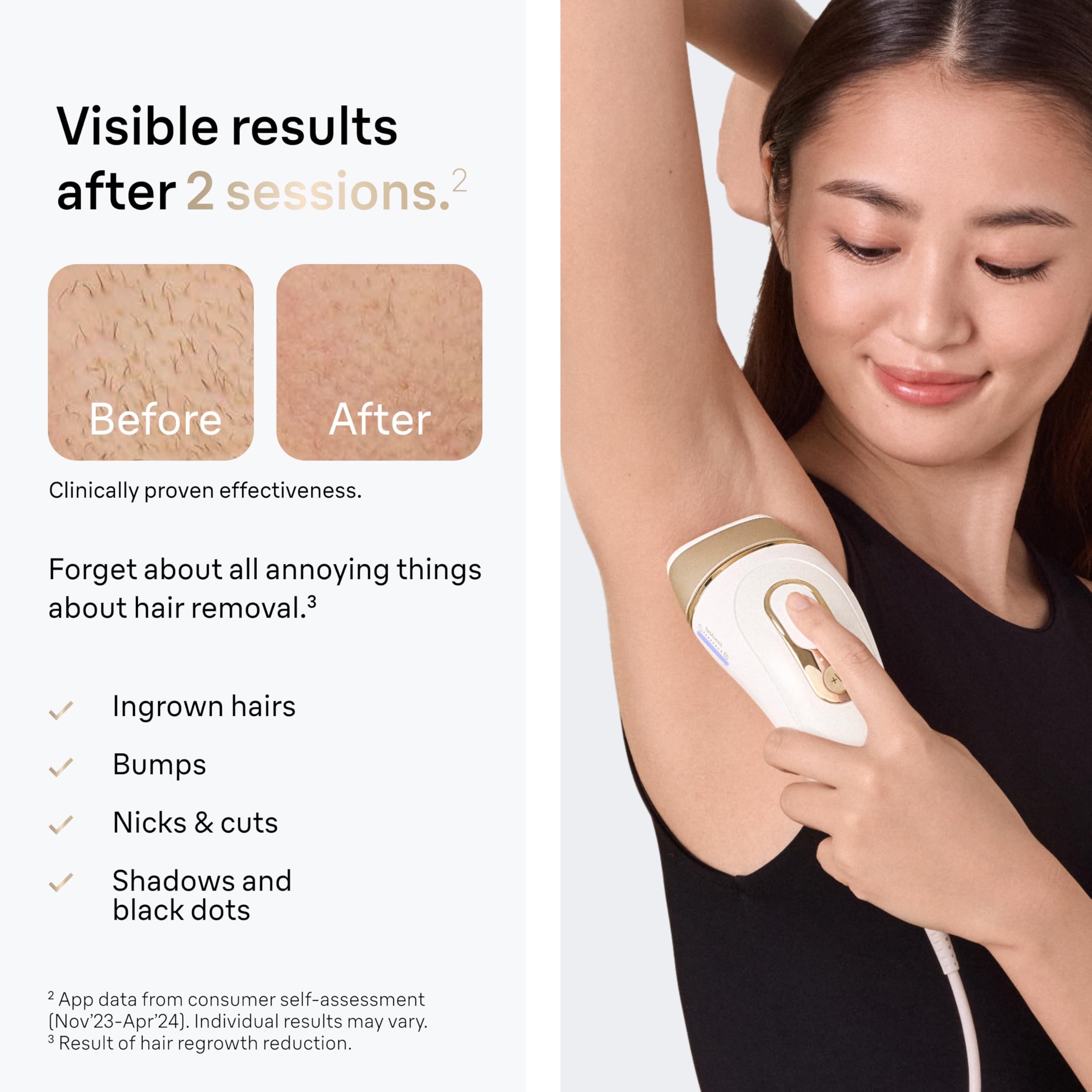 Braun IPL Silk·Expert Pro 5 PL5157 Permanent Hair Removal Device for Women & Men - Latest Generation IPL Laser with Precision Head & Travel Pouch - At-Home Hair Removal System for Legs, Bikini Line, Underarms & Face - Perfect Holiday Gift for Her & Him