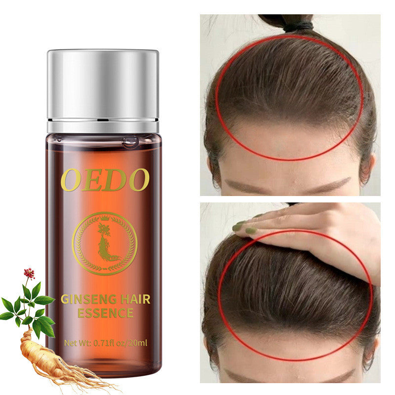 20ml Women's Hair Care Essential Oil - Moisturizing & Nourishing Treatment for Dry & Damaged Hair - Perfect for Daily Hair Care & Scalp Massage