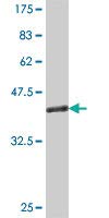 Anti-RGS5 Mouse Polyclonal Antibody - 50µl for Western Blot & Immunohistochemistry - Research Use Only