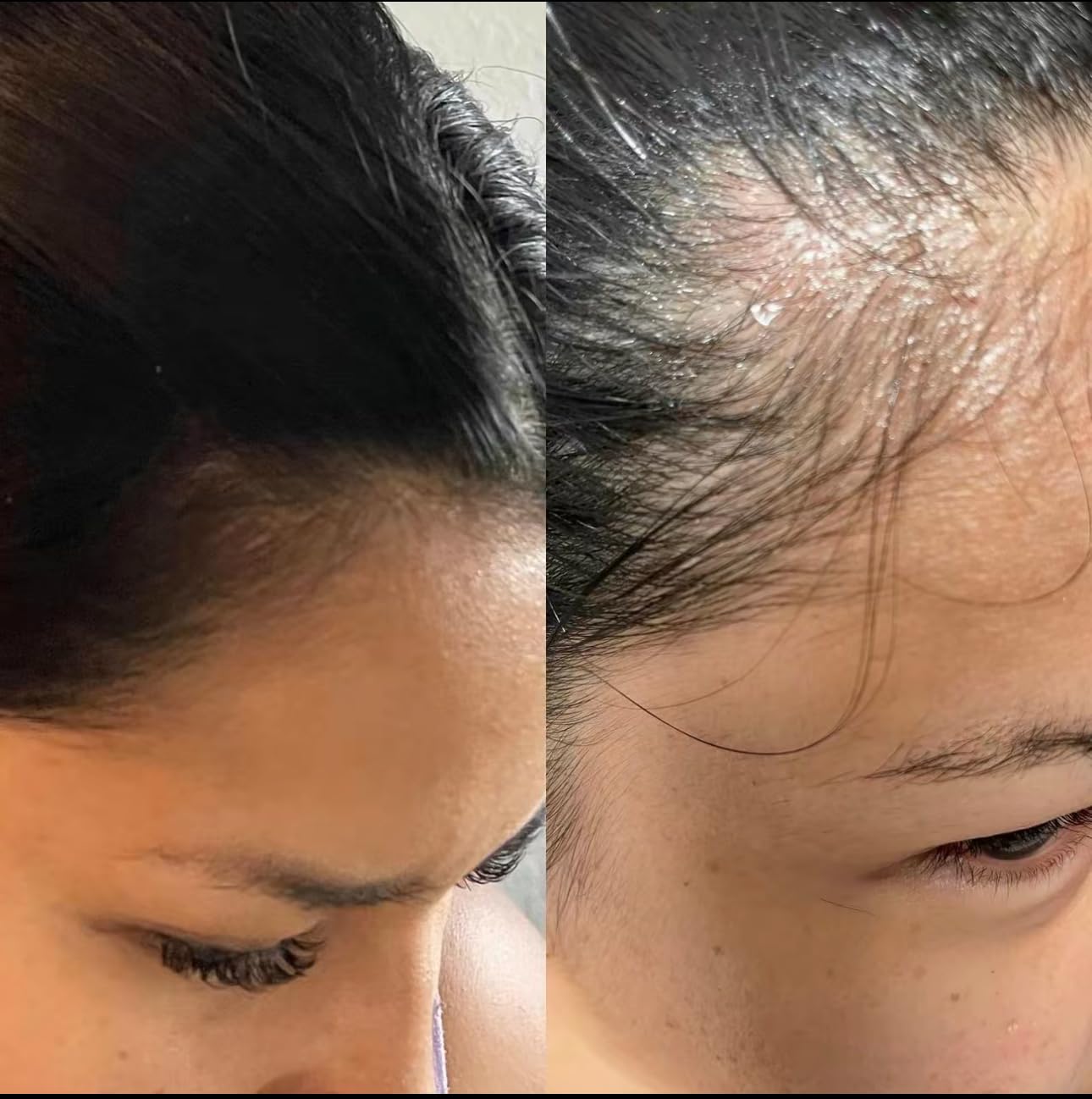 Organic Rosemary Hair Growth Oil - Plant-Based & Healthy Hair Treatment for Thicker, Stronger Hair (2oz) | TikTok Viral Hair Care for Daily Nourishment & Scalp Massage