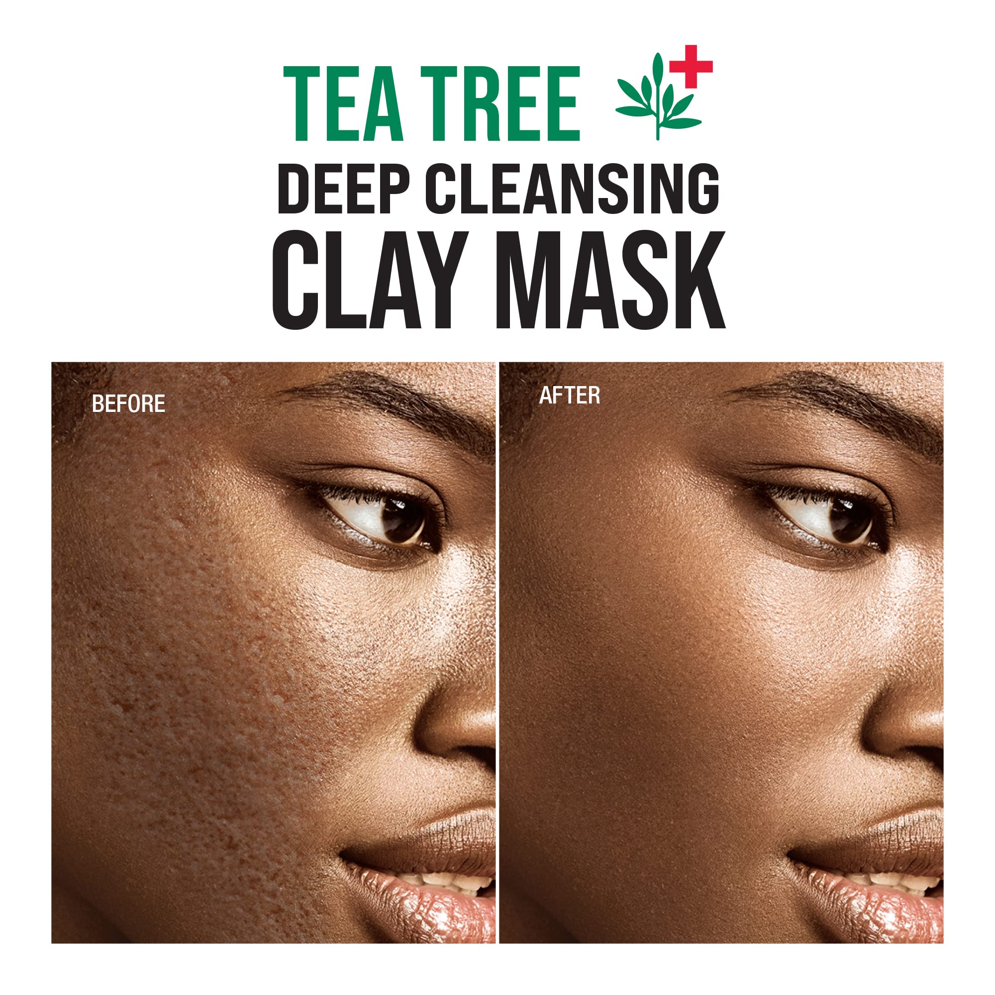 Tea Tree Deep Cleansing Clay Mask - Korean Skincare for Pore Minimizing & Oil Control | Non-Irritating, Detoxifying Facial Treatment (4.23 oz) - Perfect for Acne-Prone & Oily Skin Care Routine