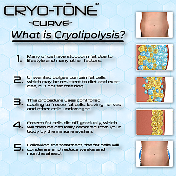 CRYOTONE CURVE ULTRA 3-Pack Muscle Recovery Pads with Extension Belt - Pain Relief for Back, Shoulder & Knee - Perfect for Post-Workout, Injury Recovery & Chronic Pain Management