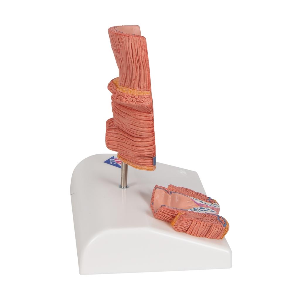 Premium Hemorrhoid Anatomy Model for Medical Training & Patient Education – Ideal for Doctors, Nurses & Healthcare Professionals
