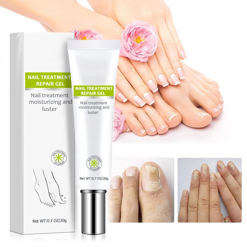 Efero Nail Treatment Repair Gel - Fungal Toenail Treatment, Nail Repair Cream for Yellow, Cracked & Split Nails - Renews Damaged Nails (4PCS) - Perfect for Home Pedicures & Nail Care Routines