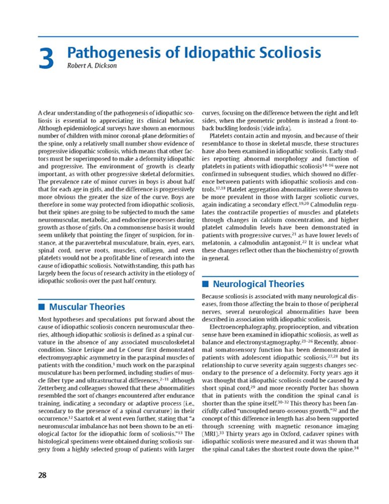 Idiopathic Scoliosis Treatment Guide - Harms Study Group Recommendations for Spinal Correction & Pain Relief | For Doctors, Physical Therapists & Patients