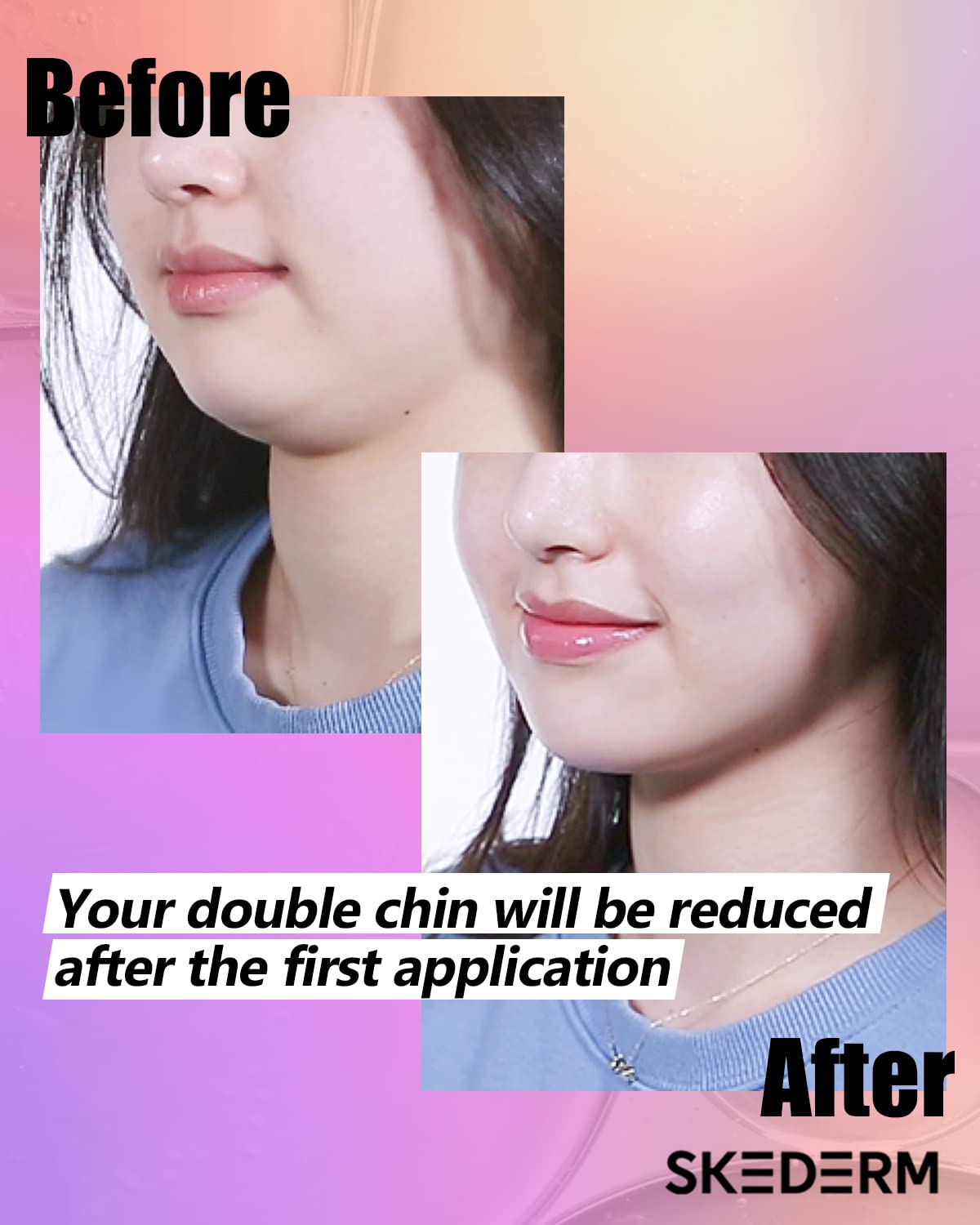 V-Shaped Lifting Patch Peptide Face Mask - Double Chin Reducer & V-Line Slimming Treatment for Jawline Contouring | At-Home Facial Care & Instant Lifting Solution