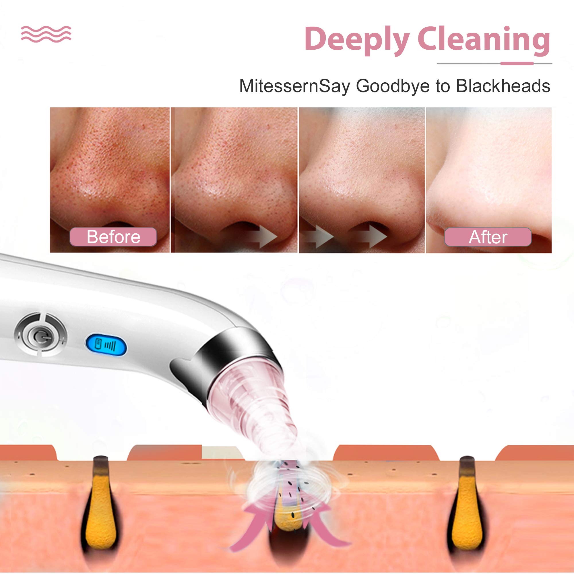 Electric Blackhead Remover - 5 Suction Power Pore Vacuum Cleaner for Face & Nose Care