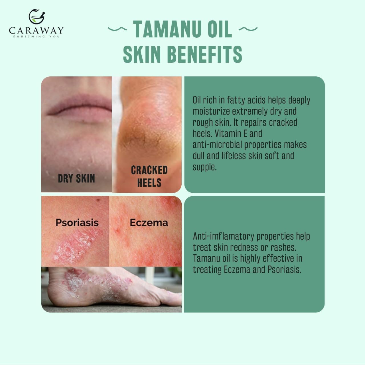Organic Cold-Pressed Tamanu Oil for Skin & Hair - Natural Moisturizer for Dry Skin, Face, Scalp - Helps Treat Hyperpigmentation, Acne Scars, Eczema, Psoriasis - 1.7 Fl oz (50ml) - Perfect for Daily Skincare Routine & Hair Treatment