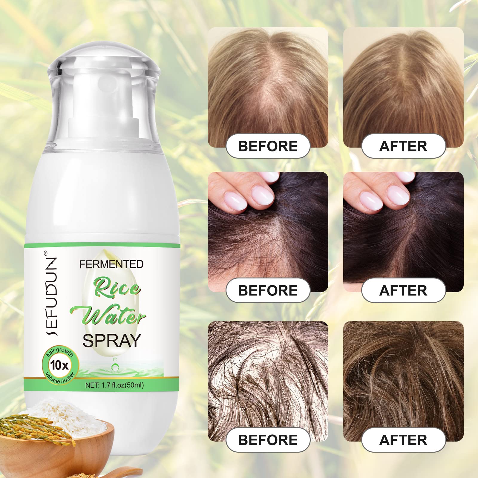 Rice Water Hair Growth Treatment Spray - Leave-in Scalp Care for Thinning Hair & Hair Loss | Castor Oil & Glycerin Formula for Stronger, Healthier Hair - 50ml | Perfect for Daily Hair Care Routine & Scalp Nourishment