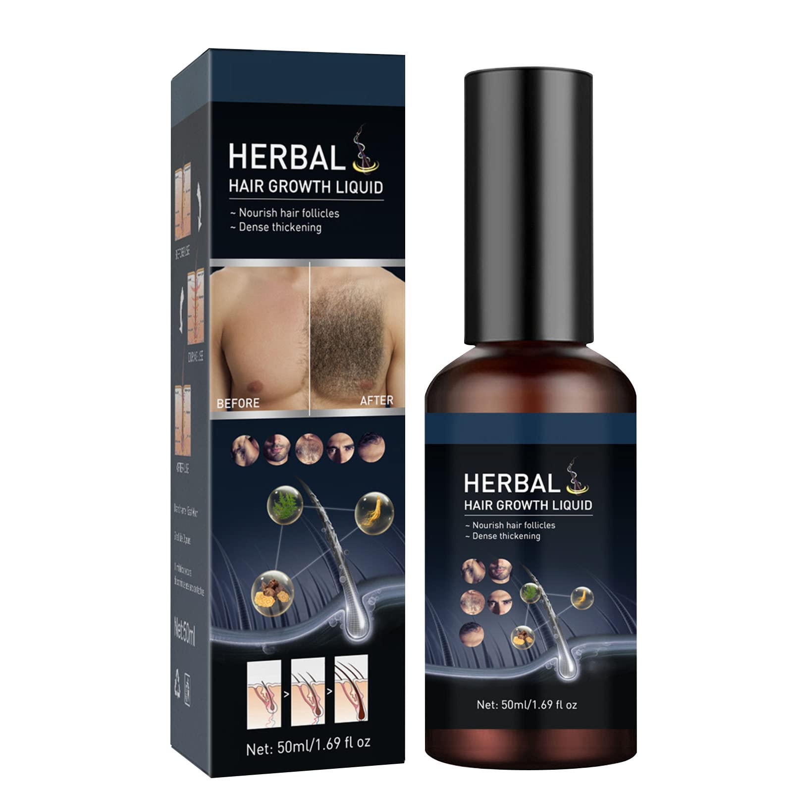 Hair Growth Oil Essence - Natural Ingredients for Faster Hair Growth & Absorption - Best for Women & Men - Perfect for Daily Scalp Massage & Thinning Hair Care