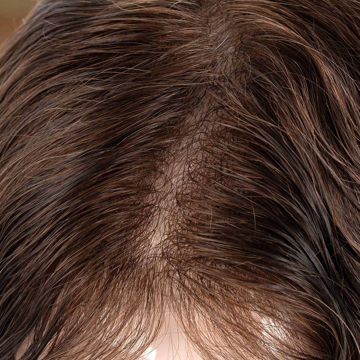 Premium 8x10 Inch Men's Hair Replacement System - 100% Human Hair Toupee with 0.03mm Ultra Thin Skin & V-loop Technology - Light-Medium Density Natural Brown Hairpiece for Daily Wear & Special Occasions