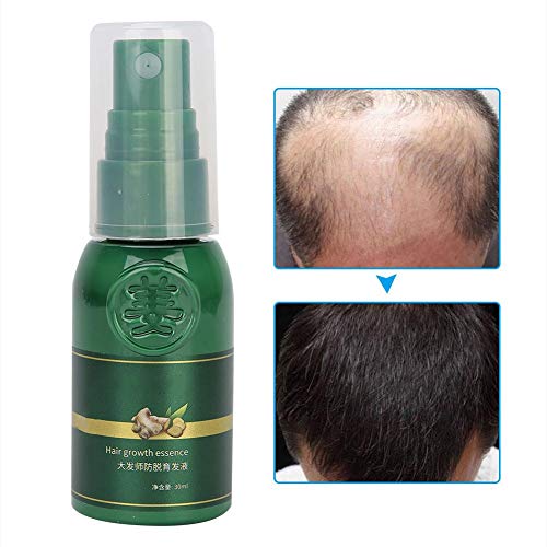 Ginger Germinal Serum for Hair Growth - 30ml Fast-Acting Hair Loss Treatment & Thinning Solution - Natural Ginger Spray for Hair Regrowth & Scalp Care - Perfect for Daily Use at Home or Salon