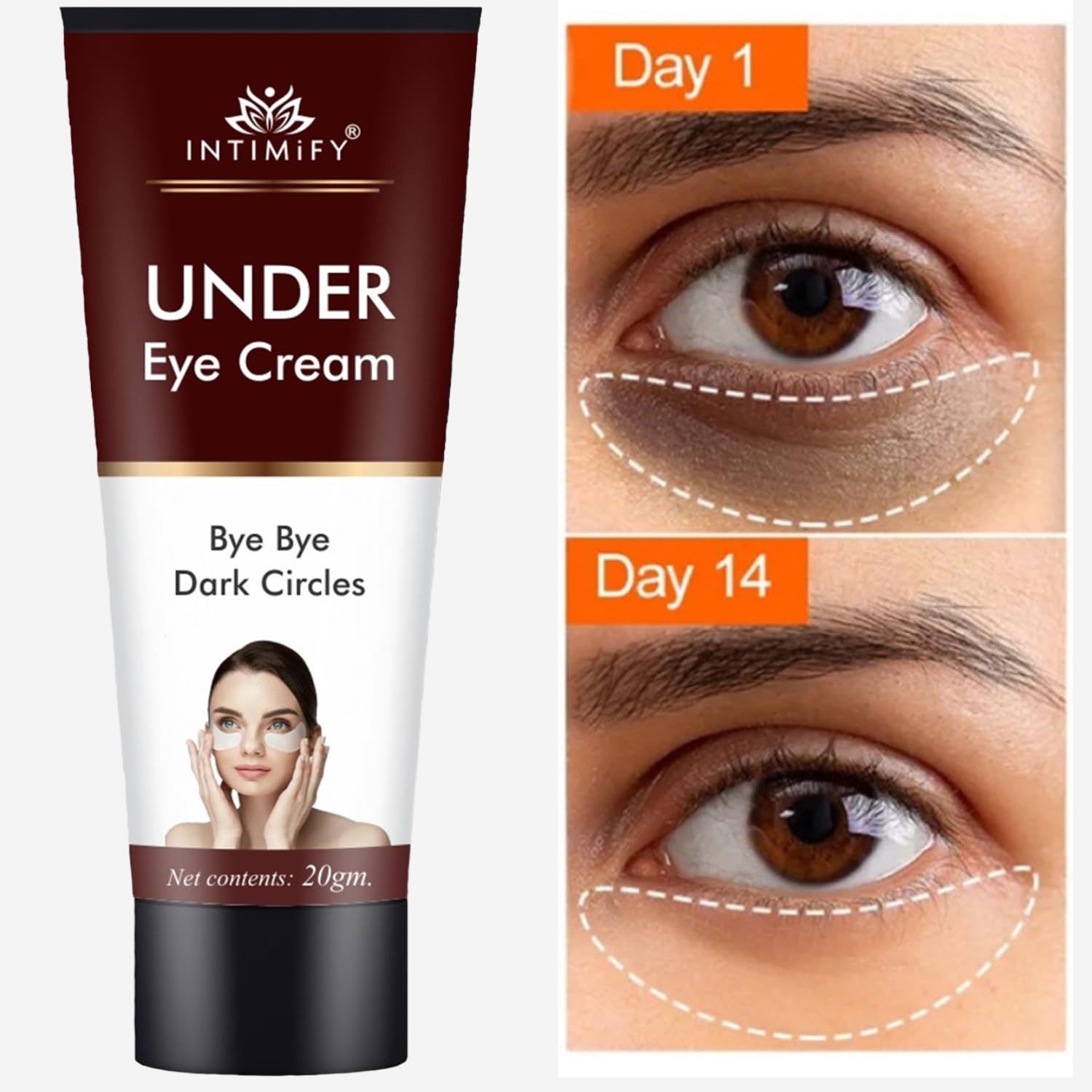 Premium Under Eye Cream for Dark Circles & Wrinkles - 20g Dark Circle Removal Treatment for Women & Men | Hydrating Eye Care Solution for Puffiness, Fine Lines & Fatigue | Day & Night Use for Brighter Eyes